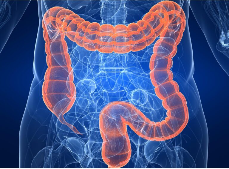 Un doctor de Harvard revela el alimento que se debe consumir para prevenir el cáncer de colon
